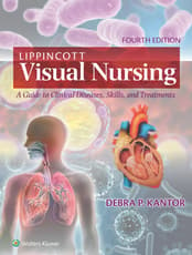 Lippincott Visual Nursing