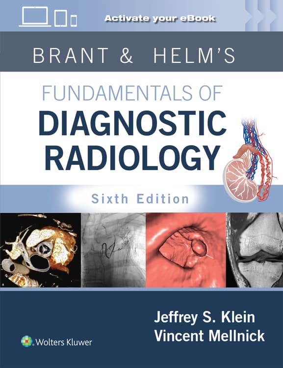 Diagnostic Radiology 7th Ed 1,2巻 Brant & Helms' Fundamentals of Diagnostic Radiology: