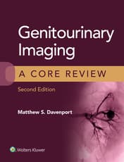 Genitourinary Imaging: A Core Review