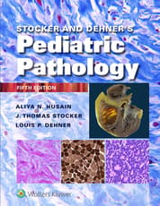 Stocker and Dehner's Pediatric Pathology