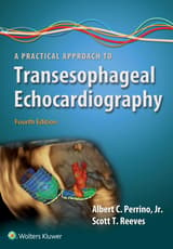 A Practical Approach to Transesophageal Echocardiography