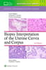 Biopsy Interpretation of the Uterine Cervix and Corpus: Print + eBook with Multimedia
