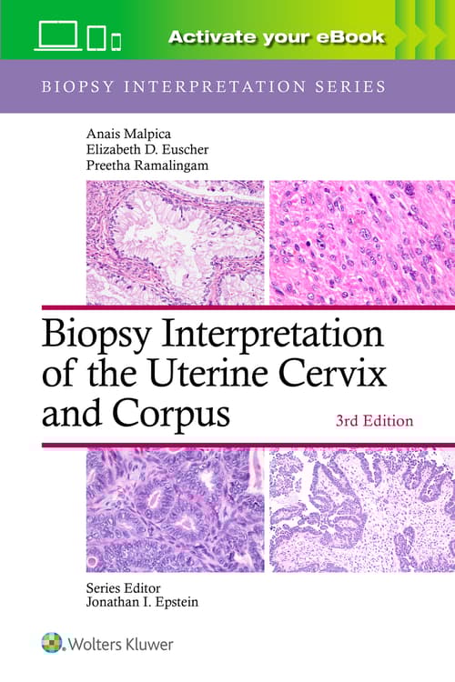 Biopsy Interpretation of the Uterine Cervix and Corpus: Print + eBook with Multimedia