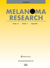 Melanoma Research Online