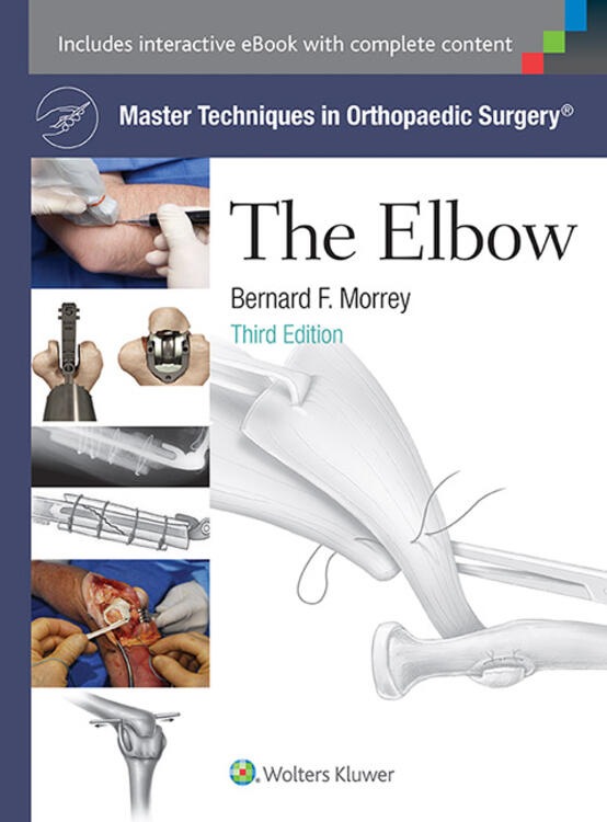 Master Techniques in Orthopaedic Surgery: The Elbow