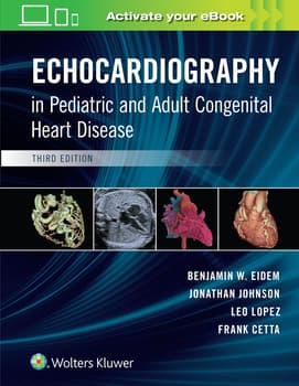 Echocardiography in Pediatric and Adult Congenital Heart