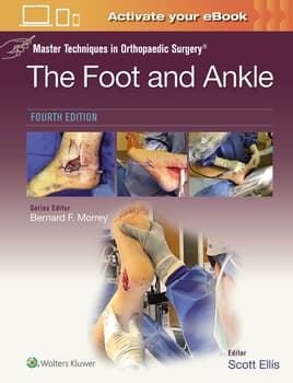 Foot and Ankle Conditioning Programs Kansas City