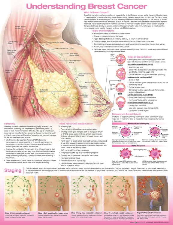 Chart The female breast, 50x70cm, Size 50 x 70 cm, Anatomical charts, Shop