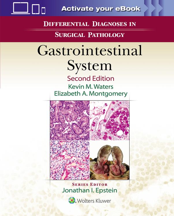 Differential Diagnoses in Surgical Pathology: Gastrointestinal System