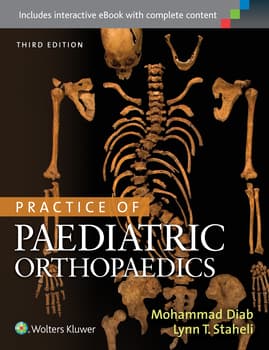 Practice of Paediatric Orthopaedics