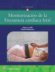 Monitorización de la frecuencia cardiaca fetal