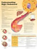 Understanding High Cholesterol Paper