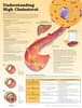 Understanding High Cholesterol Lam