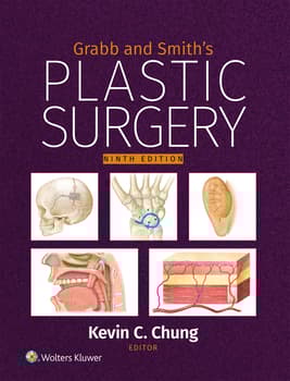 Grabb and Smith's Plastic Surgery: eBook with Multimedia