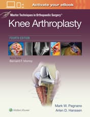 Master Techniques in Orthopedic Surgery: Knee Arthroplasty