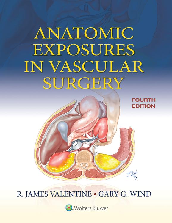 Anatomic Exposures in Vascular Surgery