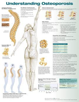 Understanding Osteoporosis Anatomical Chart