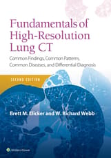 Fundamentals of High-Resolution Lung CT