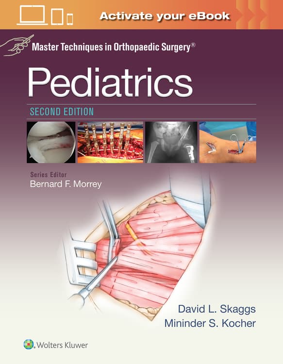 Master Techniques in Orthopaedic Surgery: Pediatrics