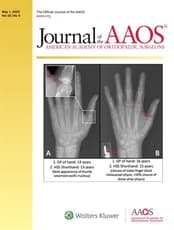 JAAOS®,  - Journal of the American Academy of Orthopaedic Surgeons