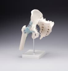 Hip Joint