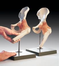 Functional Model of the Hip Joint