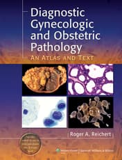 Diagnostic Gynecologic and Obstetric Pathology