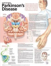 Understanding Parkinson's Disease Anatomical Chart