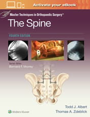 Master Techniques in Orthopaedic Surgery: The Spine