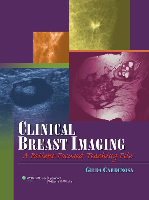 VitalSource ebook for Clinical Breast Imaging