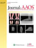 JAAOS®,  - Journal of the American Academy of Orthopaedic Surgeons