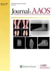 JAAOS®,  - Journal of the American Academy of Orthopaedic Surgeons