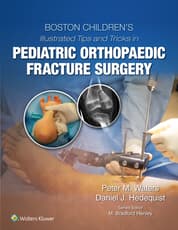 Boston Children's Illustrated Tips and Tricks  in Pediatric Orthopaedic Fracture Surgery