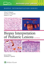 Biopsy Interpretation of Pediatric Lesions: Print + eBook with Multimedia