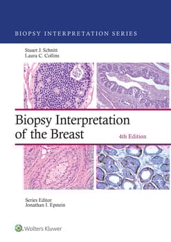 Biopsy Interpretation of the Breast: eBook with Multimedia