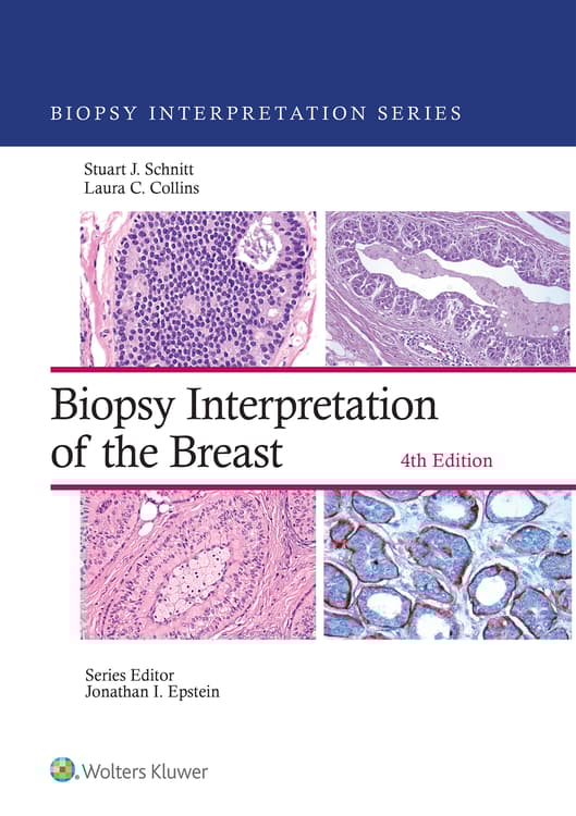 Biopsy Interpretation of the Breast: eBook with Multimedia