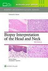 Biopsy Interpretation of the Head and Neck