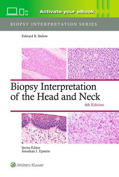 Biopsy Interpretation of the Head and Neck