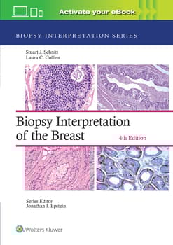 Biopsy Interpretation of the Breast: Print + eBook with Multimedia