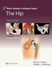 Master Techniques in Orthopaedic Surgery: The Hip: eBook with Multimedia