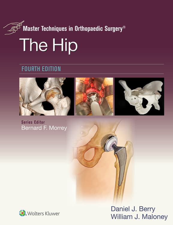Master Techniques in Orthopaedic Surgery: The Hip: eBook with Multimedia