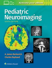 Pediatric Neuroimaging