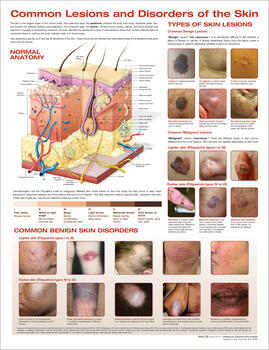 Common Lesions and Disorders of the Skin Anatomical Chart