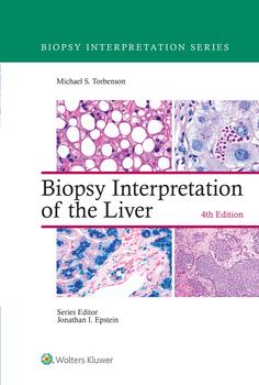 Biopsy Interpretation of the Liver