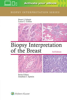 Biopsy Interpretation of the Breast