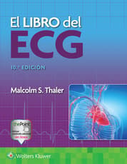 El libro del ECG