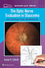 The Optic Nerve Evaluation in Glaucoma