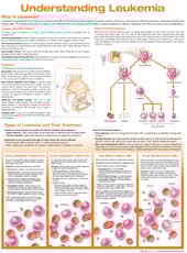 Understanding Leukemia Anatomical Chart