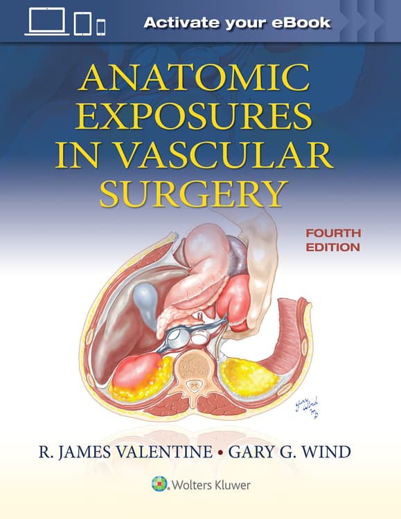 健康・医学 ANATOMIC EXPOSURES IN VASCULAR SURGERY Anatomic Exposures in Vascular Surgery