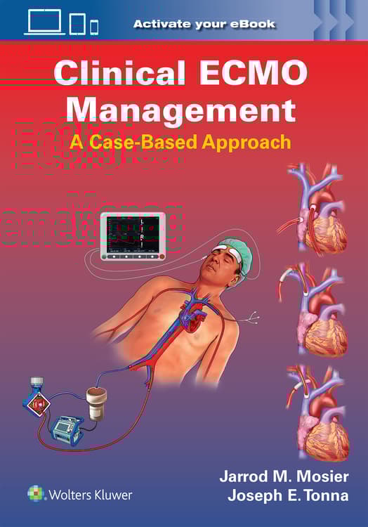 Clinical ECMO Management
